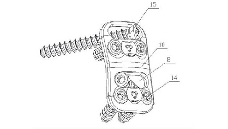 Imagination of screw machine supplier development